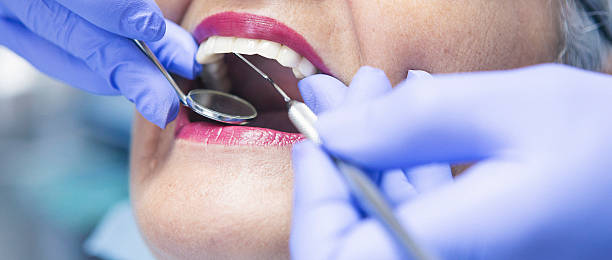 Best Emergency Broken Tooth Repair in Ephrata, PA
